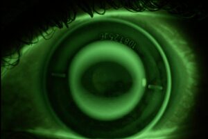 Macsa ID has its eye on the contact lens market