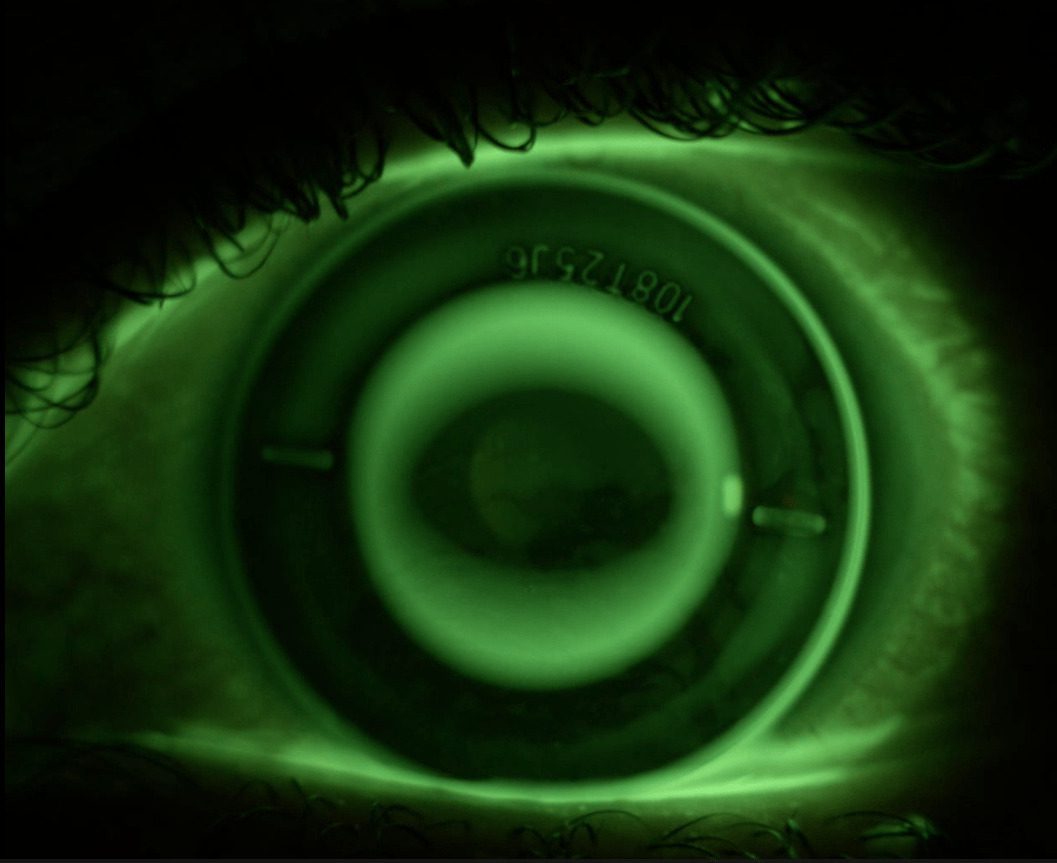 Macsa ID has its eye on the contact lens market
