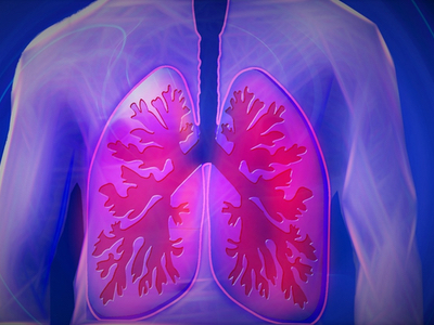 MedImmune and Sanofi Pasteur join up for RSV antibody