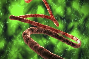 Merck Ebola vaccine trial in Guinea shows promising results