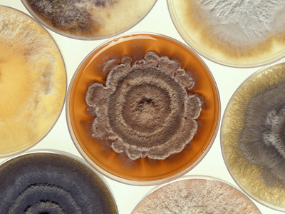Microbial identification of drug contamination: MALDI-TOF MS as an efficient alternative
