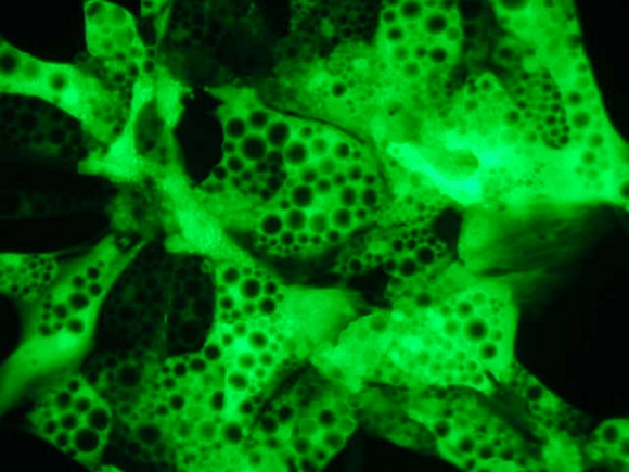 Millipore releases AdenoSilence vectors for RNAi delivery