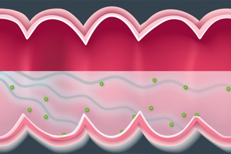 MIT researchers use ultrasound to improve drug delivery