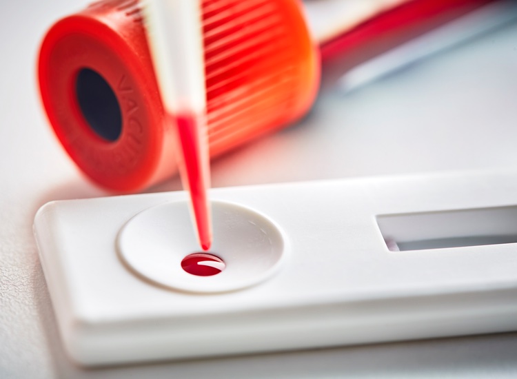 Mologic completes new ultra-sensitive rapid diagnostic test