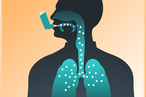Nemera organises an expert review on the present and future of inhalation products