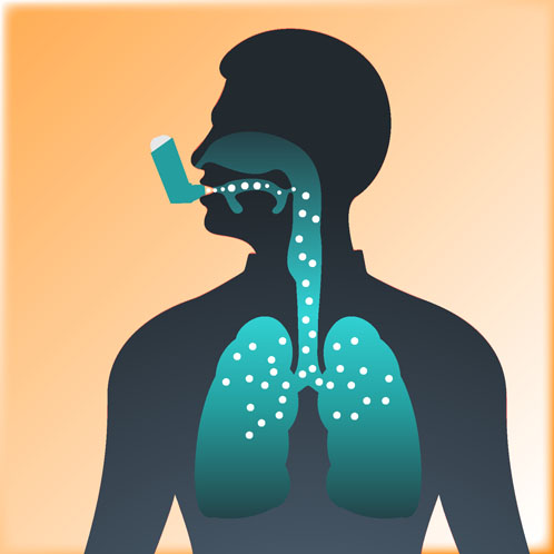 Nemera organises an expert review on the present and future of inhalation products