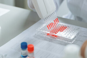 NeoCura and PhoreMost announce collaboration on cancer therapeutics