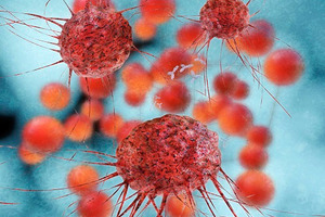 New insight into aggressive breast cancers
