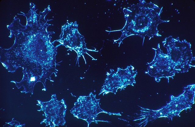 New research highlights potential of iOnctura strategy combining autotaxin and TGF-β inhibitors in cancer