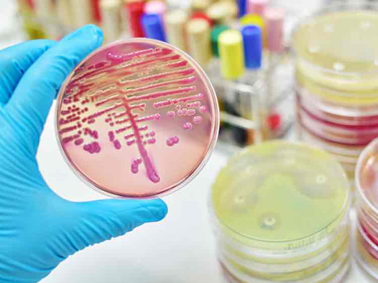 Nosopharm chooses Evotec to advance next-gen Odilorhabdin drug candidate