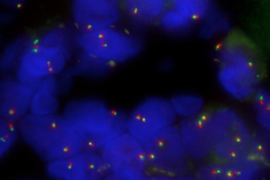 OGT expands Cytocell sarcoma FISH probe range