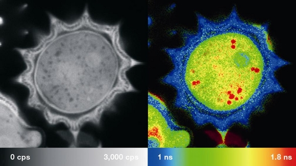 Olympus adds further advanced capabilities to the FluoView FV1000 confocal laser scanning microscope