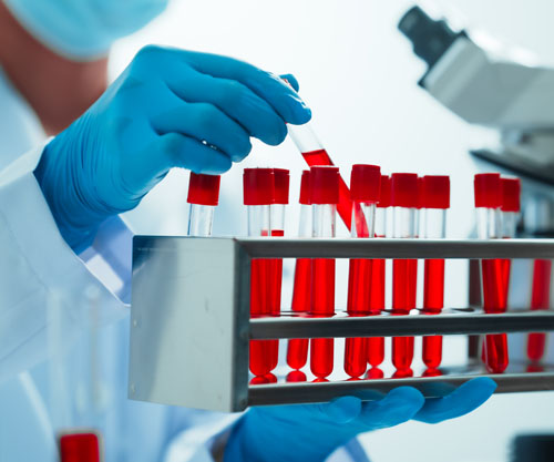 Oncopeptides partners with SD Pharma to further broaden Pepaxti reach in Spain