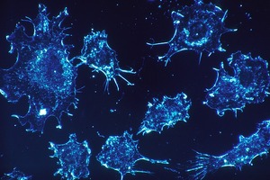Orion and MSD announce two Phase III trials to evaluate ODM-208/MK5684 in patients with metastatic castration-resistant prostate cancer