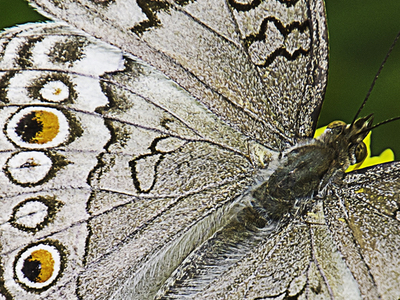 Orphan drug for butterfly skin syndrome