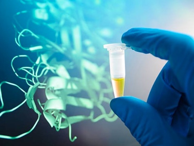 Ovarian cancer survival linked to protein, finds study