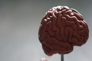 Parkinson’s UK and Domainex collaborate on inflammation therapy