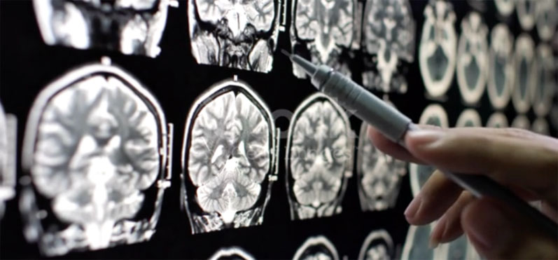 PharmaKure and Universiti Teknologi MARA (UiTM) announce Alzheimer’s partnership