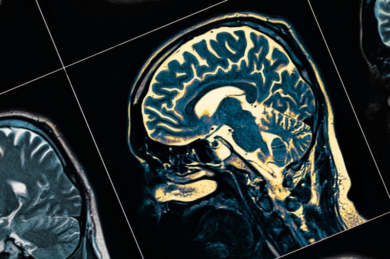 PharmaKure announces collaboration with Sheffield Hallam University to understand mechanisms of Alzheimer’s Diseases