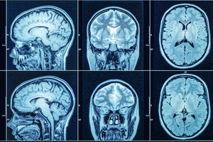 PhoreMost announces PMC-001 as lead oncology programme