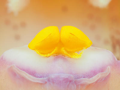 Pipeline drug offers treatment for platinum-resistant ovarian cancer