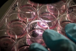 Plasticell and GSK collaborate to produce hematopoietic cells