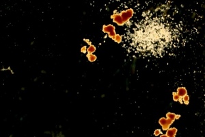Plasticell’s CombiCult platform expands stem cells in umbilical cord blood