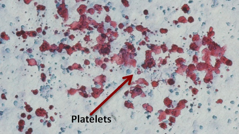 Plasticell wins military contract to develop regenerative medicines