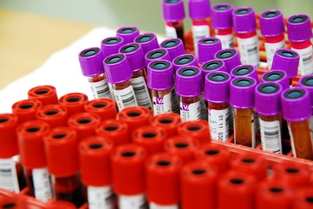 Preserving blood – why we need to look at new options