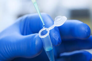 Protein concentration of the active pharmaceutical ingredient (API)