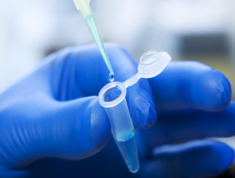 Protein concentration of the active pharmaceutical ingredient (API)