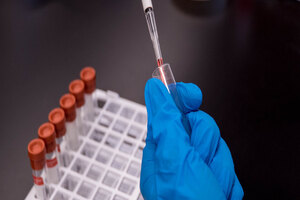 Queen’s University Belfast enters FLIP inhibitor collaboration