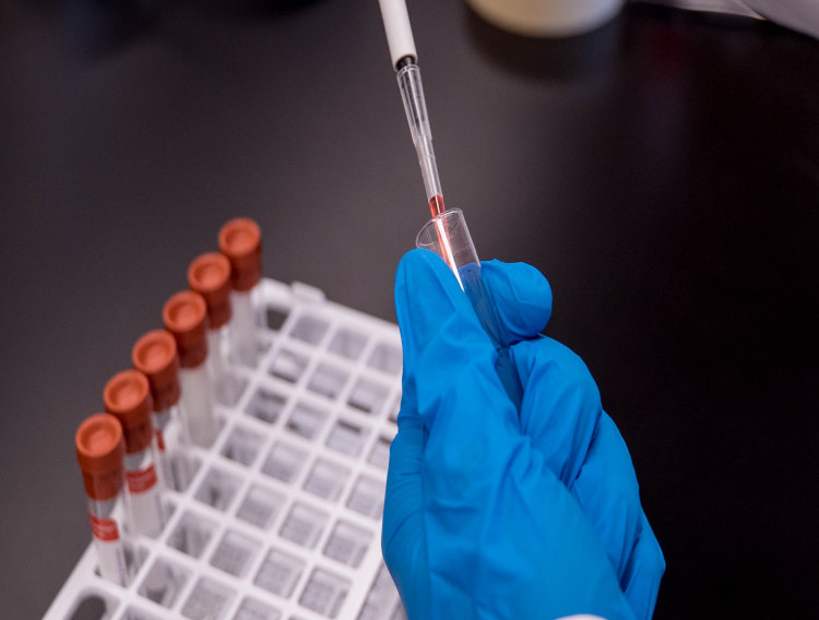 Queen’s University Belfast enters FLIP inhibitor collaboration