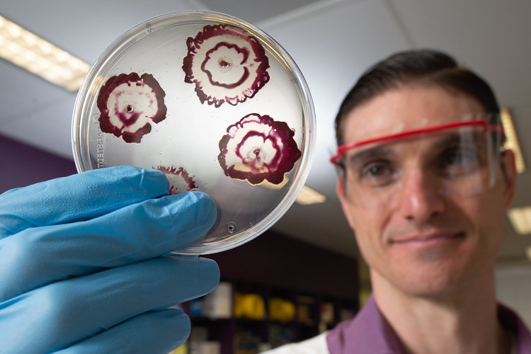 QUT research shows promising results for biofilm eradication 