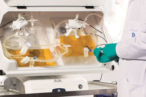 Realising the potential of single-use technology