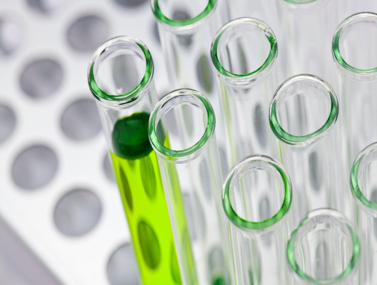 Recipharm launches laboratory to expand analytical services offering