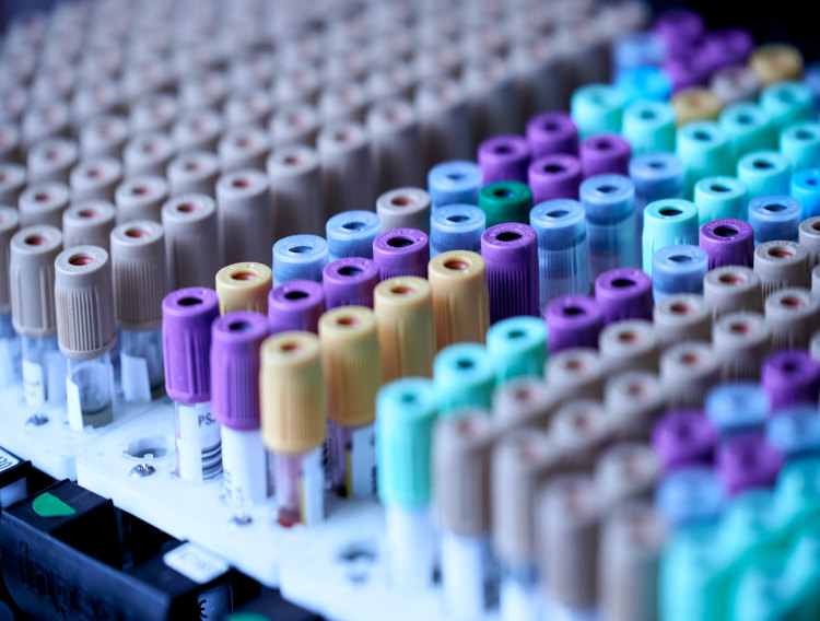 Recipharm signs deal for vaccine filling at Kayserberg