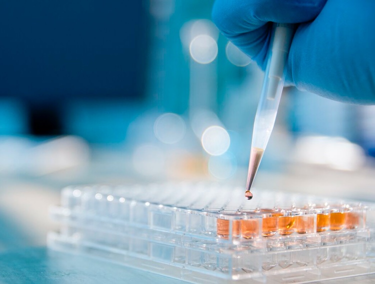 Recombinant Factor C assay to aid demand for LAL endotoxin testing
