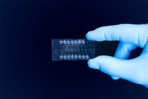 Refeyn enhances mass photometry capabilities with new microfluidic chip