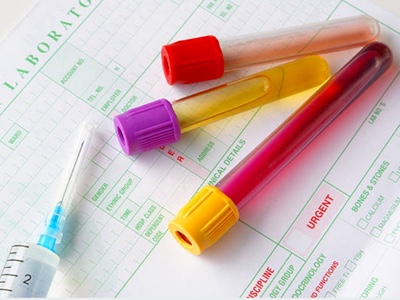 Researchers develop process to efficiently harvest cancer cells
