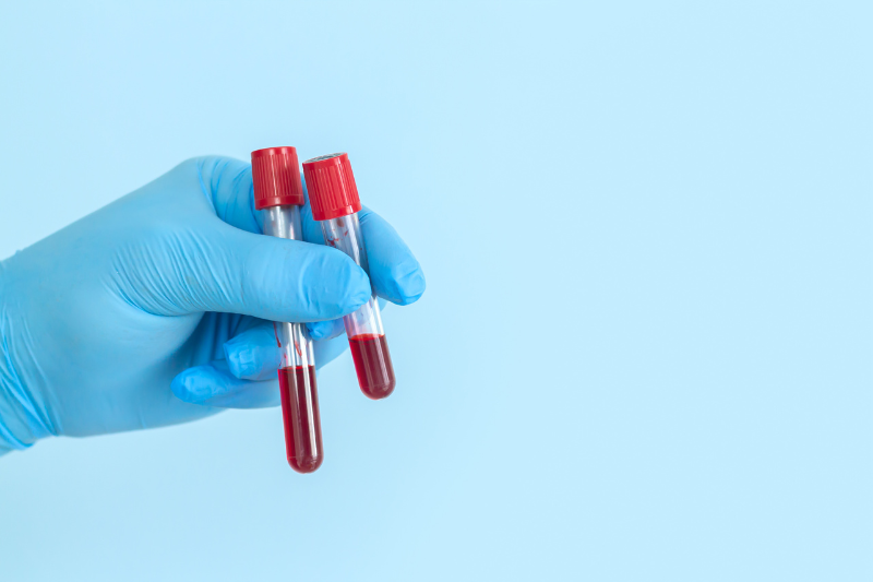 Researchers identify early signs of Parkinson's in the blood
