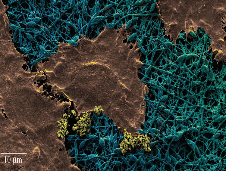 RMIT University develops smart wound dressing