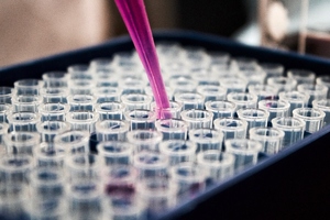 Sanofi and Teva's collaboration to deliver inflammatory bowel disease treatment