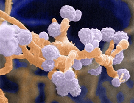 Scientists solve an enzyme puzzle at the bottom of the Pacific Ocean
