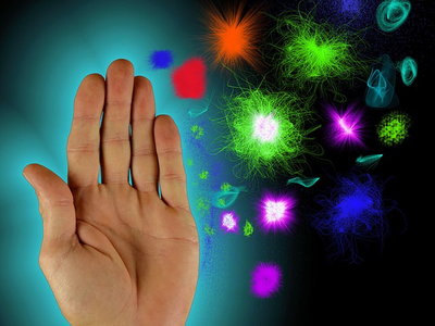 Sebia signs agreement with Janssen to develop multiple myeloma IVD test