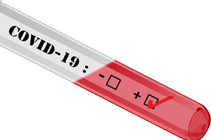 SGS enrols first patient into Biophytis COVA clinical study
