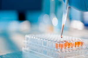 SGS increases its capacity for human challenges studies 