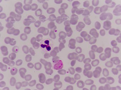 SGS to conduct first malaria human challenge trial in Belgium