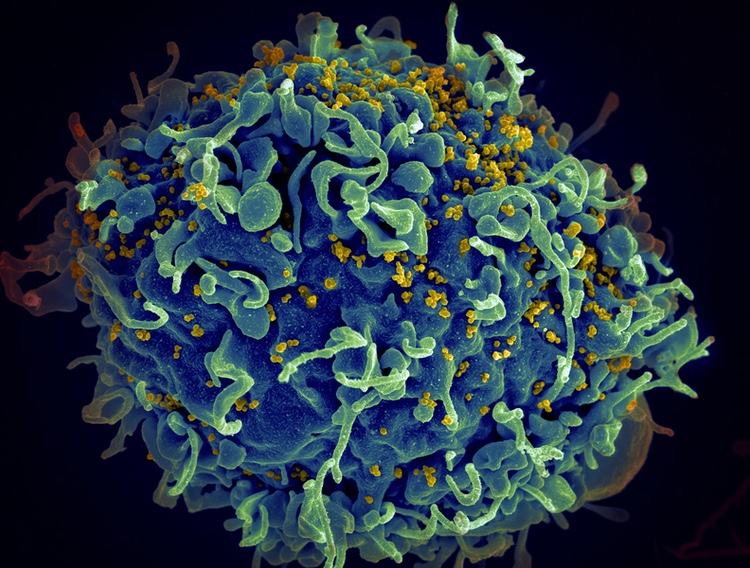 Societal CDMO wins tech transfer and production contract for HIV drug candidate