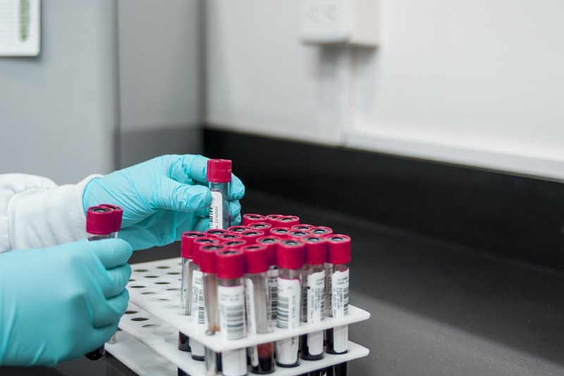 Sphere Fluidics launches Cyto-CellectPLUS to accelerate cell line development workflows